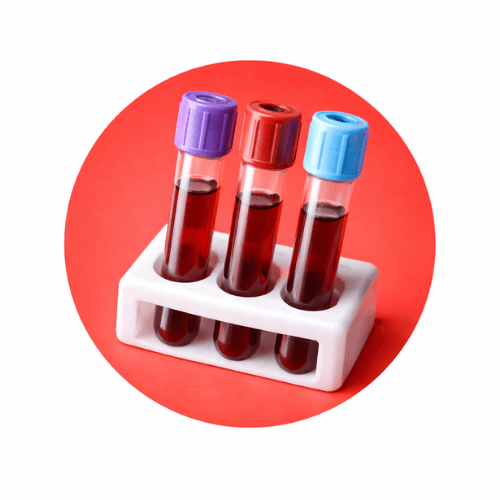 Blood Tests